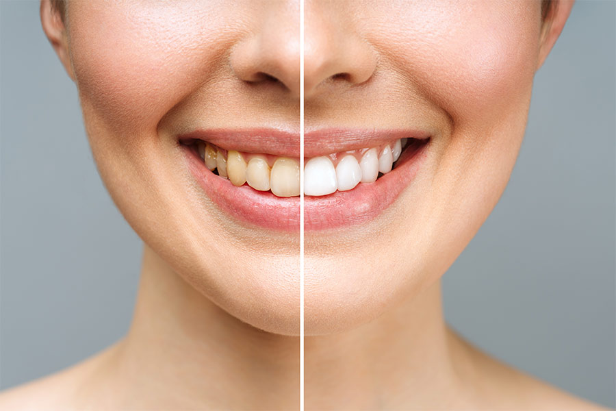 Cosmetic dentistry in Naples Florida